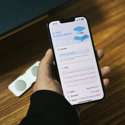 Portable ECG Monitor PM10 – Track Your Wellness Trends Anytime, Anywhere
